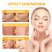 Tyemp Honey Mask 2PCS for Blackhead Control and Dead Skin Removal - 0.01 oz (Pack of 2) - Buy Online on GoSupps.com