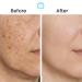 OMIC+ Skincare 7.5% Cysteamine Triple Complex Cream - 1.01 fl Oz / 30ml Brightening & Tone-Improving Face Cream for Uneven Skin & Dull Complexion Lightweight Texture - Buy Online on GoSupps.com