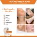 Medical Grade Silicone Scar Tape Roll - Postpartum Belly Band for Scars, Keloids, Burns & Thyroid - 1.6 x 60 | Effective Scars Removal Solution - Buy Online on GoSupps.com