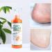 Foot Peeling Spray Orange Oil Foot Peeling Spray That Remove Dead Skin Tea Tree Foot Peeling Spray Remove Dead Skin within Seconds Exfoliator For Cracked Rough Heels Dry Toe Skin&Calluses (Orange) - Buy Online on GoSupps.com