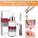 1PC Nail Treatment Nail Renewal Solution Toenails & Fingernails Nail Repairs Essential Oil Protects From Discoloration Brittle And Cracked Nail(12ML) 111 - Buy Online on GoSupps.com