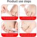 Chodofo Toe Separator Hallux & Hammer Toe Correction Strap - Rubber & Fabric Wraps - Buy Online on GoSupps.com