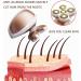 2020 Newest Version Hair Remover - Smooth & Silky Results Guaranteed - Buy Online on GoSupps.com