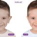 Kids Ear Corrector - Protruding Ear Sticker for 12-72 Months | Non-Surgical Ear Pinning | 20 Correctors + 10 Solaps - Buy Online on GoSupps.com