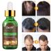 Hair Growth Serum - Stimulate New Growth, Thicker & Fuller Hair - Hair Loss & Thinning Treatment - Buy Online on GoSupps.com