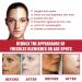 BOKIOESDE Women Face Whitening Serum Natural Ingredient Moisturizing Hydrating Nourishing Essence Female Portable Beauty Supplies - Buy Online on GoSupps.com