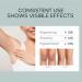 Face and Body Whitening Cream Skin Lightening Cream for Dark Skin Skin Bleaching Cream with Retinol for Acanthosis Nigricans Hard Skin Body Moisturiser Fade Melanin on Body Armpit Knees Elbows - Buy Online on GoSupps.com