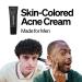FRONTMAN Fade Skin-Colored Acne Cream for Men - L1 Light Shade 0.33oz - Buy Online on GoSupps.com