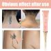Mandurs 7 Days Tattoo Removal Cream - Fast & Painless Gel for Colored & Black Ink - 2PCS - Buy Online on GoSupps.com