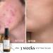 47 Skin Silver Chitoderm Anti Blemish Scar Repair Serum 100ml - Hydrating Face Serum for Acne and Scars - Mandarin Scent - Buy Online on GoSupps.com