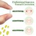 RMISODO 60-Piece Ingrown Toenail Corrector Strips - Professional Toenail Correction Patches for Curved Toenails - Paronychia Correction Pedicure Tool - Buy Online on GoSupps.com