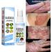 BLEDD Melllop Herbal Psoriasis & Vitiligo Relief Spray 2023 - Itchy Skin Relief - Psoriasis & Vitiligo Spray - 1pcs - Buy Online on GoSupps.com