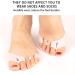 Milisten Toe Separator Hammer Toes Support Crest Pad - 2 Pairs | Toe Straightener Corrector for Hallux Valgus and Plantar Fasciitis - Buy Online on GoSupps.com