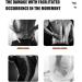 Back Support Back Brace Lumbar Support Abdomen Shaper Compression Beer Belly Slimmer Stomach Wraps Workout Band Sports Back Support Belt(Black 3X-Large) XXX-Large Black - Buy Online on GoSupps.com