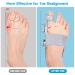 Premium Bunion Corrector for Women & Men - Adjustable Big Toe Brace with Gel Separators for Pain Relief - Universal Left & Right Foot Support (Grey - Buy Online on GoSupps.com