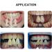 Dental Clinic 29 Colors Teeth Whitening Shade Guide 3D Shades Teeth Bleach Tooth Shade Guide - Buy Online on GoSupps.com
