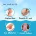 Chemist at Play Foot Cream for Cracked Heels & Diabetic Foot | Up to 24 hours of Moisturization | 10% Urea & Natural AHAs | Nourishment & Hydration | For Dry & Cracked Feet | Lightweight | 50g - Buy Online on GoSupps.com