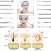 Pimple Blackhead Remover Kit - 7 in 1 Extractor Tool Set - Buy Online on GoSupps.com