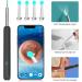 Xeerun Ear Wax Removal Otoscope - IP67 Waterproof WiFi Ear Cleaner with 1080p Camera & 6 LEDs for iOS iPad Android - 360 Wide Angle - Buy Online on GoSupps.com