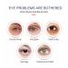 KBTPMTL Awaken Peptide Depuffing Eye Gel - Men's Gentle Care Eye Cream for Puffiness, Dark Circles, Bags, Wrinkles, Fine Lines - Buy Online on GoSupps.com