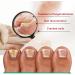 Kerassentials Huile de traitement antifongique pour ongles d'orteils restauration des ongles d color s et endommag s pour un aspect sain s r - Buy Online on GoSupps.com