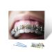 Paint by Numbers Kit for Adults cosmetic dentistry orthodontics dental metal wire teeth brackets 16x20" DIY Color by Numbers Acrylic Paint Framed Canvas Painting Kits for Beginner Students Teens Color5 16 x 20 inches