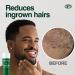 FRONTMAN Smooth - Glycolic Acid Ingrown Hair Treatment for Men - 1.7 Fl Oz - Buy Online on GoSupps.com