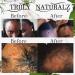 Natural Rapid Growth Grease | Balding Balm for Fast Hair Growth | Reduce Hair Loss & Dandruff - Buy Online on GoSupps.com