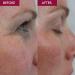 SKINICIAN Advanced Eye Repair Cream for Reducing Fine Lines & Wrinkles - Instantly Ageless Under Eye Cream - Peptide Complex Serum for Eye Brightening - Vegan & Cruelty Skincare (15ml) - Buy Online on GoSupps.com