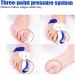 Alleviate Foot Pain with Hallux Valgus Corrector - Toe Straightener Bunion Corrector for Men and Women - Orthopedic Toe Brace with Separators & Spacers - Buy Online on GoSupps.com
