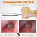 Yannies Ear Wax Removal Endoscope Ear Wax Removal Camera with 4.3 IPS Screen 1280x1080 FHD Smart Visual Ear Cleaner with Camera Tool Kit Plug & Play at Home Ear Infection Detector Ear Wax Remover O - Buy Online on GoSupps.com
