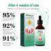 Gum Regrowth Drops 30ML Gum Regrowth Treatment Drops Rejuvenate Your Gums with Ease Repair Gum Regrowth for Receding Gum - Buy Online on GoSupps.com