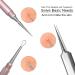 Nekoo Professional Facial Milia Removal Tool & Whitehead Extractor | High Grade Stainless Steel Double Ended Needle & Tweezers Kit for Blackhead & Acne Removal (S512IN-P) - Buy Online on GoSupps.com