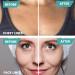 Facial Wrinkle Remover Strips - 256pcs Anti-Aging Patches & Chest Pad for Smooth Skin - Buy Online on GoSupps.com