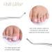 Lusofie 5Pcs Cuticle Nipper Trimmer Set | Stainless Steel Manicure Tools for Fingernails & Toenails - Buy Online on GoSupps.com