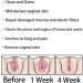 Annie Care Natural Detox Vaginal Gel & Capsules Set - Anti-Itch, Slimming & Repair Formula (3 Boxes) - Buy Online on GoSupps.com