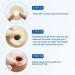 Ostomy Barrier Rings - Mouldable Colostomy Rings for Stoma Care | Prevent Leakage - Pack of 10 - Buy Online on GoSupps.com