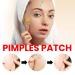 Buy Hydrocolloid Facial Acne Patches - 200 Tablets with Tea Tree Oil & Salicylic Acid for Effective Pimple Treatment - Buy Online on GoSupps.com