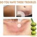 Allayu Body Brightening Serum Elbows Chest Armpit Moisturizing Hydrating Essence Stocking Solution Skin Care - Buy Online on GoSupps.com