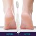 Foot Rasp Foot File Foot File Callus Remover Foot Scrubber - Shower Foot Scrubber Skin Removal Foot File Callus Remover Long Handled Toe Brush for Wet and Dry Feet White - Buy Online on GoSupps.com