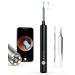 Xlife Ear Wax Removal  Ear Wax Removal Tool with 1080P Ear Camera  Ear Cleaner with Blackhead Remover Tool Set  Ear Camera and Wax Remover with A 3.5mm Ultra-Thin Lens for iPhone ONLY (X3 Black)