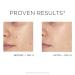 IDC Dermo Glowfix Peel Cotton Pads - Vegan Exfoliating Facial Rounds with Glycolic Acid - 60 Pads for Men & Women - International Shipping Available - Buy Online on GoSupps.com