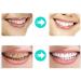 4Pcs Moldable Teeth Whitening Mouth Trays - Dental Oral Care Kit for Teeth Whitening, Bleaching, Grinding & Protection - Buy Online on GoSupps.com