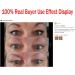Breathable Slim Lace Eyelid Tape - Medical Grade for Hooded or Droopy Eyes - Buy Online on GoSupps.com