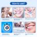 Blisstaar Teeth Whitening Set - 32x LED Bleaching Lamp & 3 Tooth Bleach Gel Pens for Instant Brightening & Diamond Smile - Buy Online on GoSupps.com