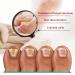 Kerassentials Toenail Fungus Treatment - Healthy Skin, Hair & Nails - 2PC Pack of 1 Fl Oz - Buy Online on GoSupps.com