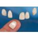 Ultra Thin Tooth Whitening Veneers for Missing or Broken Teeth | Realistic Cosmetically Enhanced Smile | Shade A-2 - Buy Online on GoSupps.com