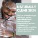Naturally Solved Tea Tree Shower Gel (200ml) - Anti-Fungal Body Wash for Jock Itch, Thrush, Acne & Athlete's Foot - Buy Online on GoSupps.com