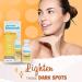Buy Bye Bye Blemish Dark Spot Lotion with Vitamin C - 29.5 ml | Brightening & Skin Repair for All Skin Types - International Shipping Available - Buy Online on GoSupps.com