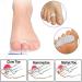 4x Silicone Gel Toe Separator for Hammer Toe & Hallux Valgus Correction - Comfort & Pain Relief - Buy Online on GoSupps.com